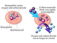 GtB Decompression Sickness  (DCS)